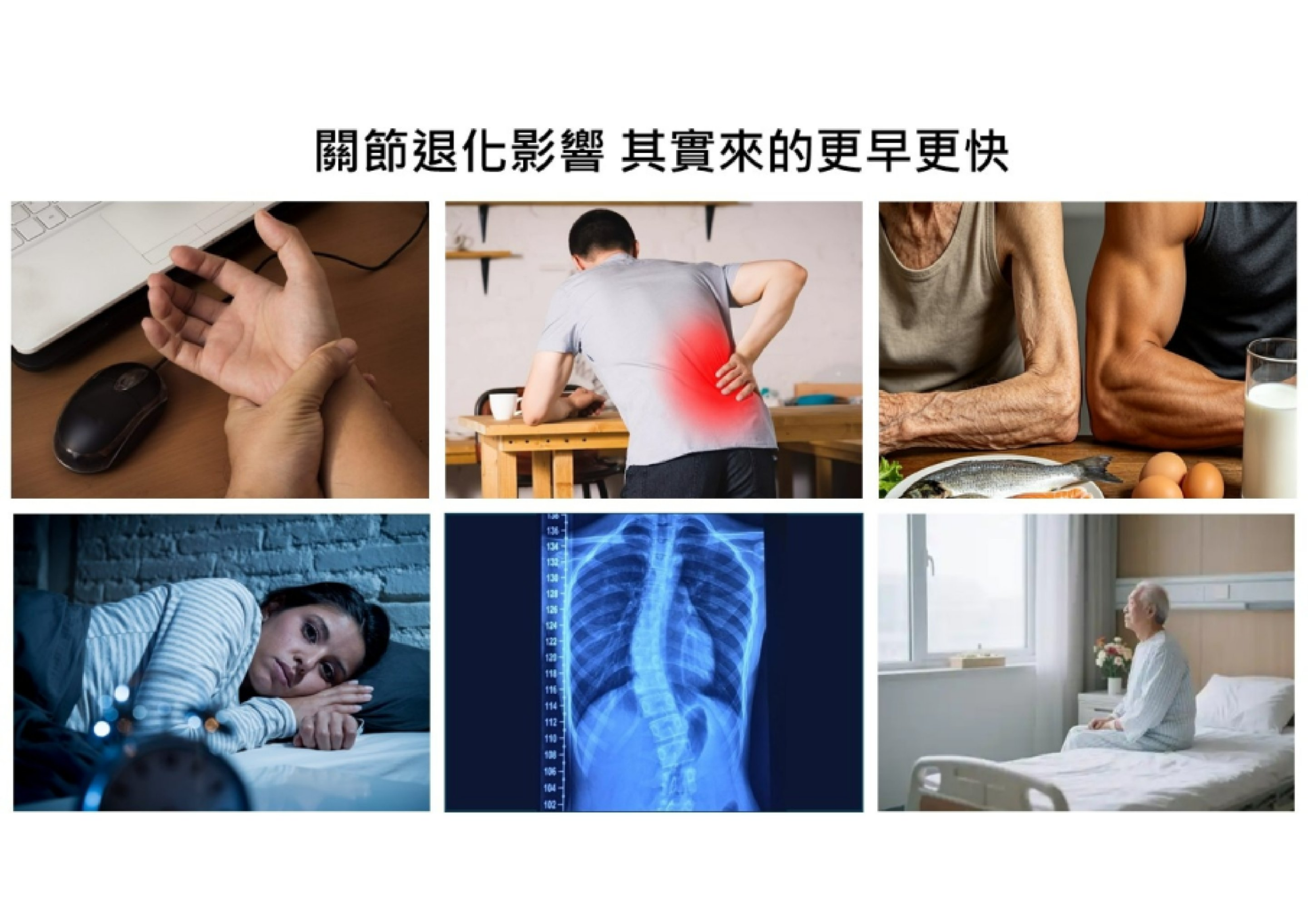 關節退化影響 · 6 種早期症狀